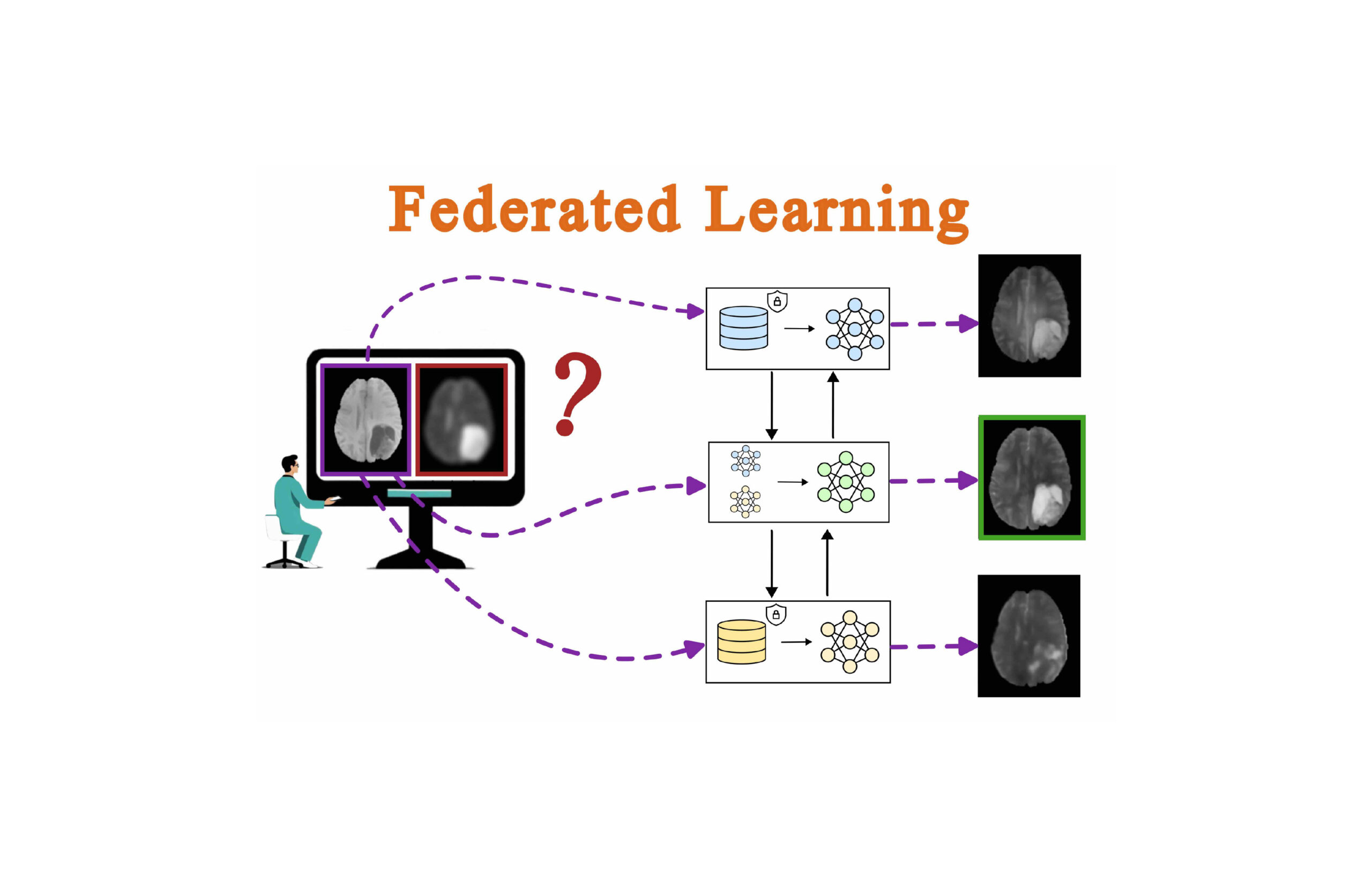 Validation of eleven federated learning strategies for multi-contrast ...